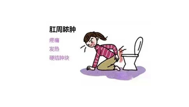 一块骨头竟然可以引起肛周脓肿！